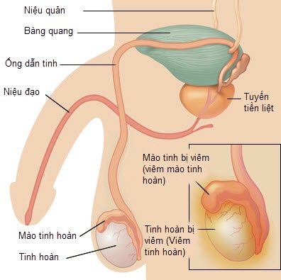 phongkhamroyal's tweet photo. THẾ NÀO LÀ VIÊM TINH HOÀN?
Vô sinh, mất khả năng tình dục, viêm nhiễm ngược dòng đều là những tác hại khôn lường mà viêm tinh hoàn có thể gây ra.
Chi tiết xem tại: https://t.co/xJm3wVo4wI https://t.co/rhO9PC5DNh