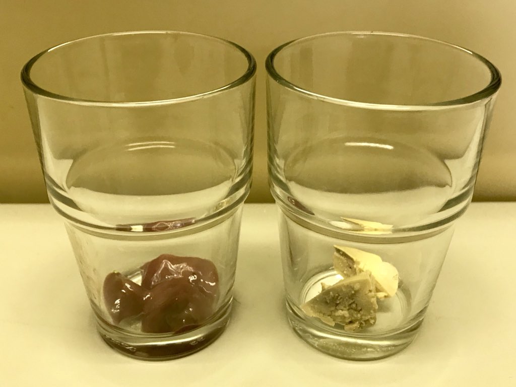 早川昌志 ミクロ ライフpj 酵素の実験 左には 生のレバー 右には ゆでたレバー オキシドール 過酸化水素水 を加えると 生のレバー側では過酸化水素が分解されて酸素が発生するが ゆでたレバー側では発生しない レバーに多く含まれる