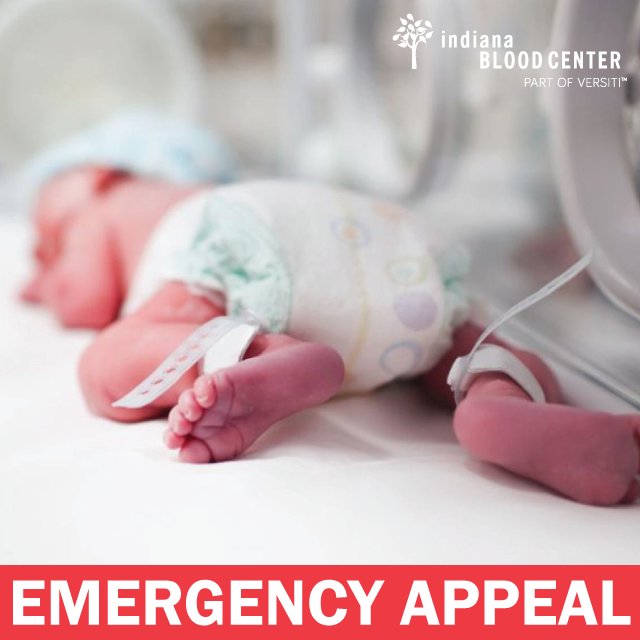 indianablood's tweet photo. ***EMERGENCY APPEAL*** We are issuing an emergency appeal for blood donations! The need is critical &amp; we can’t save lives without your help. Make an appt TODAY &amp; RT to help get the word out! https://t.co/nHQCf0EO6w  #SavingSummer https://t.co/hEnEv7d7cY