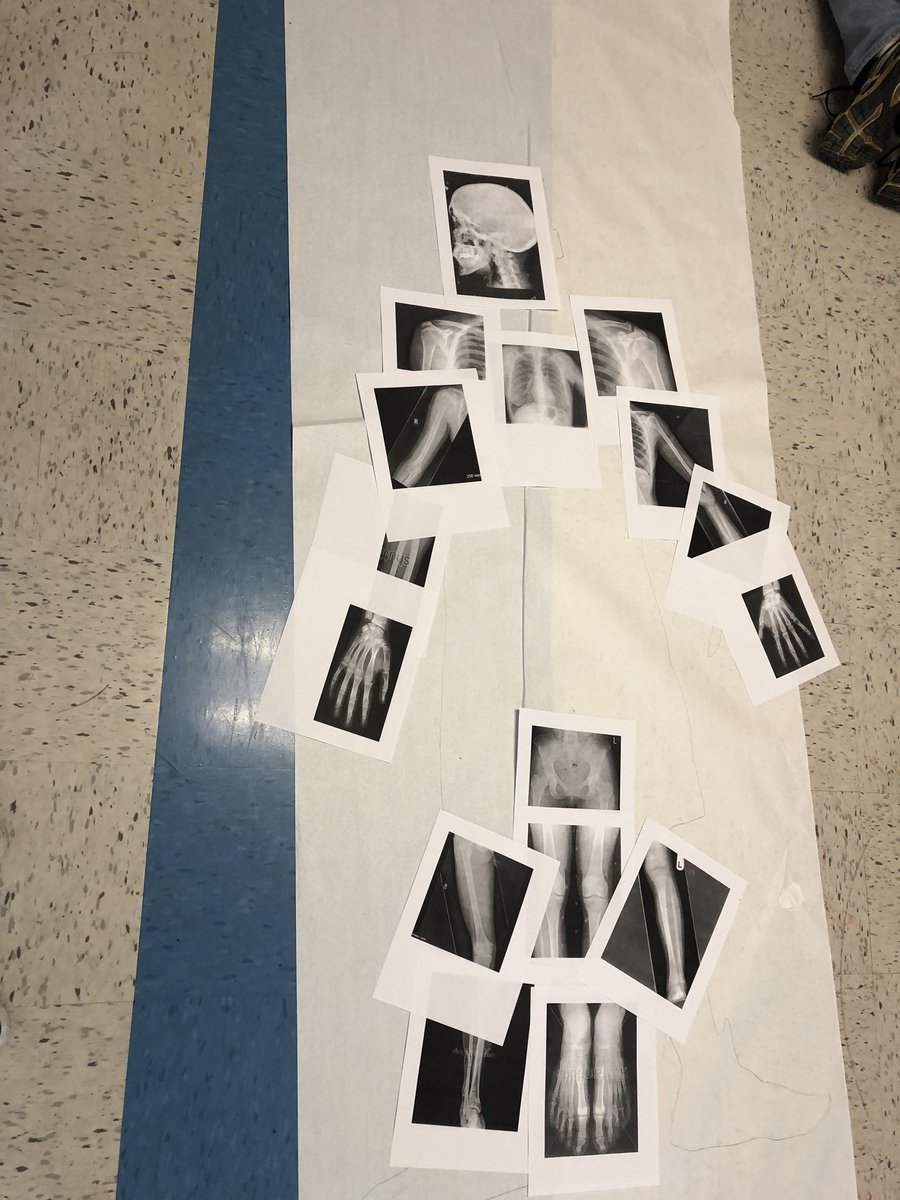 VanderbiltCSEO's tweet photo. #biology week at #SEEKcamp is starting off with learning and the bones in our body. Younger campers and coloring and labeling while older campers are using pictures of xrays! #xray #KidsInSTEM #KidBiologist #STEAM https://t.co/PzgbaofJq8