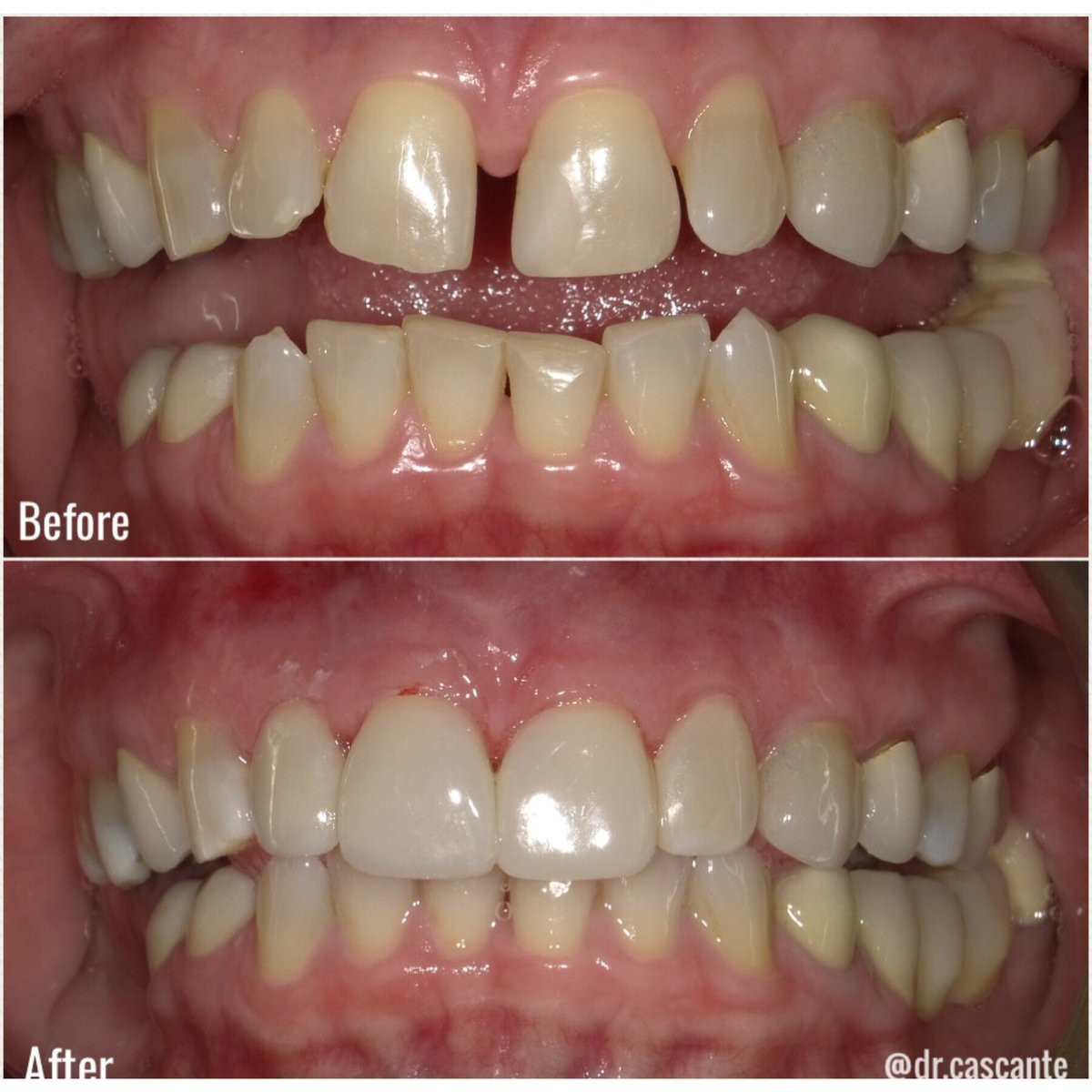 Advanced Center for Cosmetic & Implant Dentistry (drocascante) Twitter