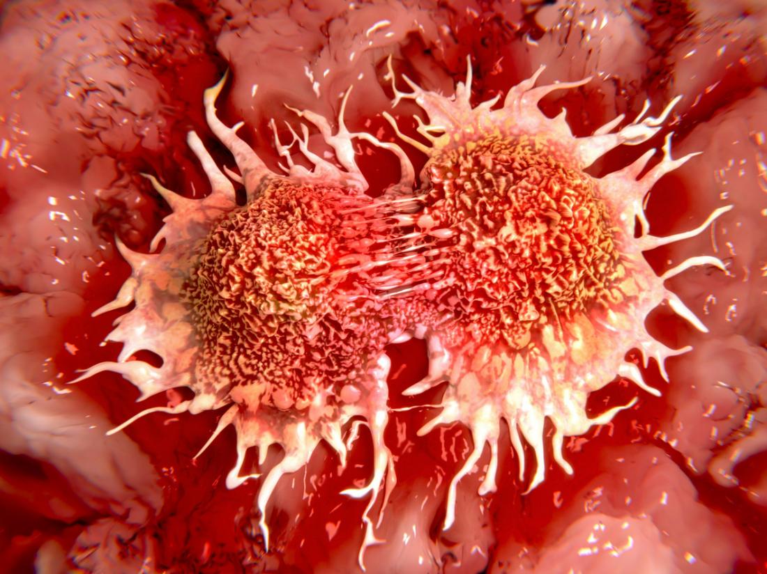 A new discovery has identified previously unknown therapeutic targets that could prevent the spread of cancer. Researchers found that by inhibiting several newly identified gene targets, they could block more than 99.5% of cancer metastasis (mice). nature.com/articles/s4146…