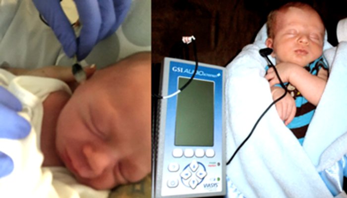ENT_AudsNews's tweet photo. “Along with the auditory brainstem response (ABR), #OAEs are now well established for infant #hearing screening.” https://t.co/EAGslcWaXq 

#audiologyhour #audpeeps #audiology #ENTAuds https://t.co/XR2GvzZqMa