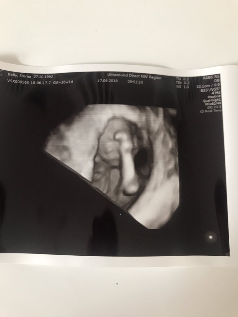 JordanParker7's tweet image. Roll on December #babyNo2 👶🏻