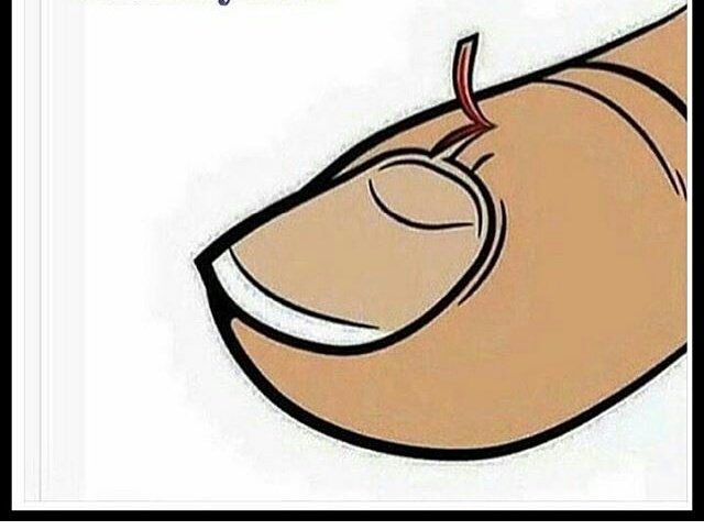 linachitosi27's tweet photo. This hurts more than a breakup https://t.co/oQRNliJkKq