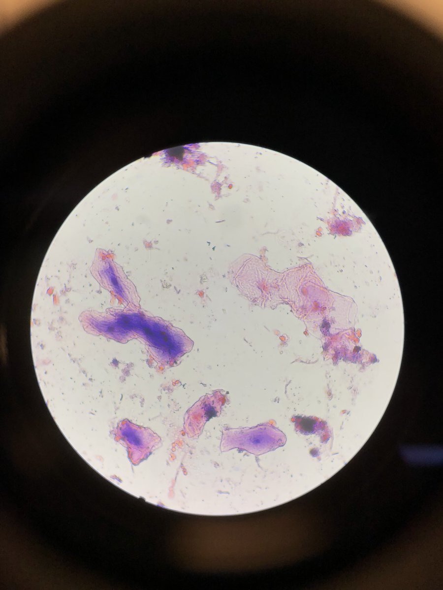 VanderbiltCSEO's tweet photo. @DC_Palbino gave us some excellent cheek cell samples #cheekcells #microbiology #SEEKcamp https://t.co/JEDvPg91LM