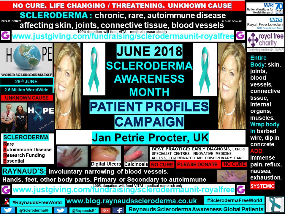 SclerodermaRF's tweet photo. #SclerodermaAwarenessMonth Global Patient Profile: Jan Procter, UK
https://t.co/4TfXakwP5f
#scleroderma #RareDisease #autoimmune #Raynauds #SclerodermaFreeWorld #RaynaudsFreeWorld #research #cure #hope #lifechanging #cardiacfailure #pah #DigitalUlcer @Worldsclerofnd
@EUSTAR_org https://t.co/ZSTkaTWfAT