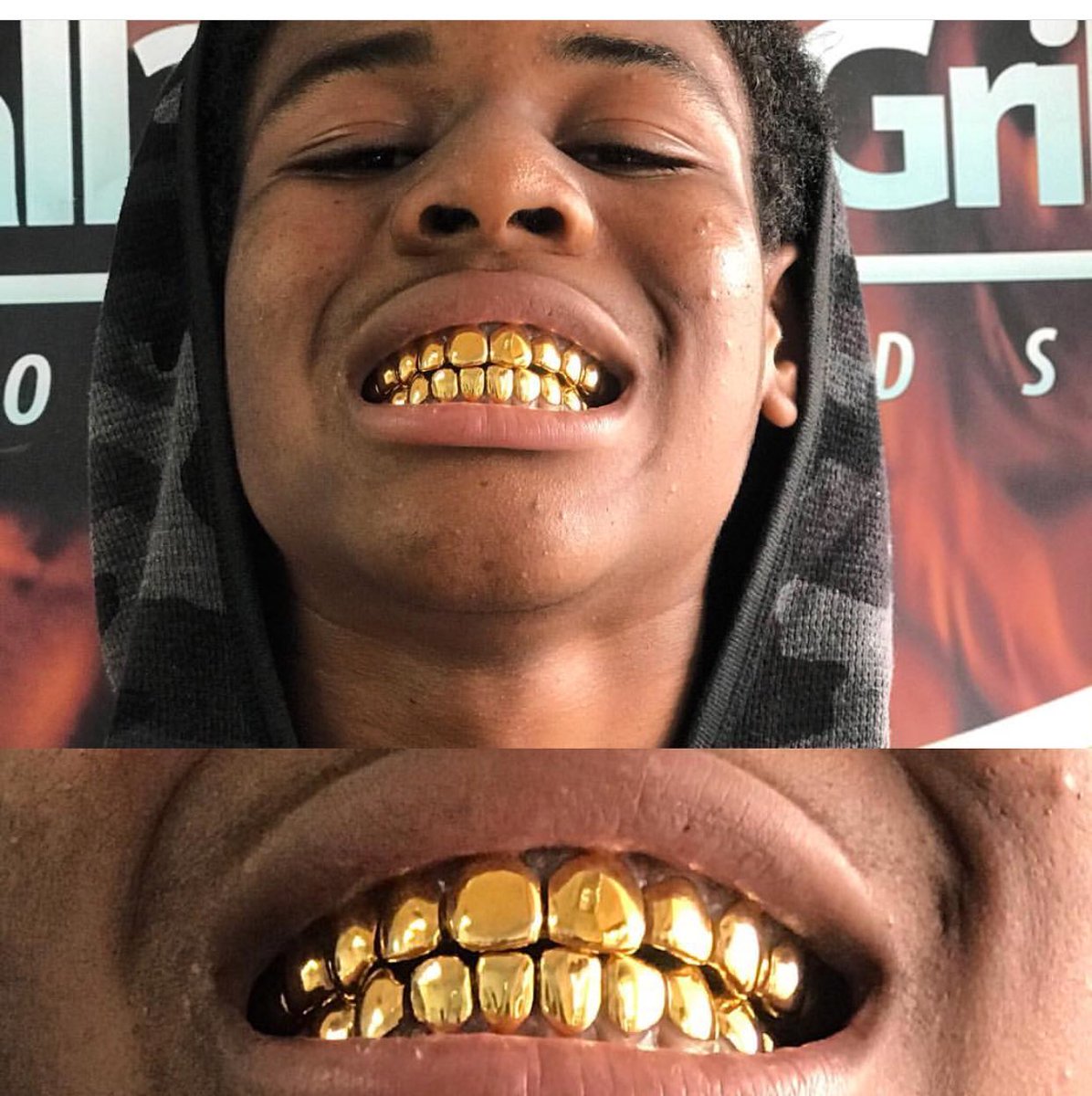 Wall2wallgrillz's tweet photo. 10T/10B NPG with 24K finish  #pulloutperm™️ come get your perfect smile 😬😬😬😬😬😬😬😬😬😬 https://t.co/4AipaEkNBb