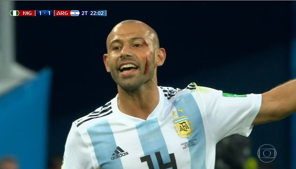 DeedfulxBpink's tweet photo. Nuestro LEÓN sin dudas, gracias por tanto masche, simplemente GRACIAS💙⚪💙
#MESSIentoEnOctavos #SomosArgentina #NGAARG https://t.co/2gQL3G5XP1