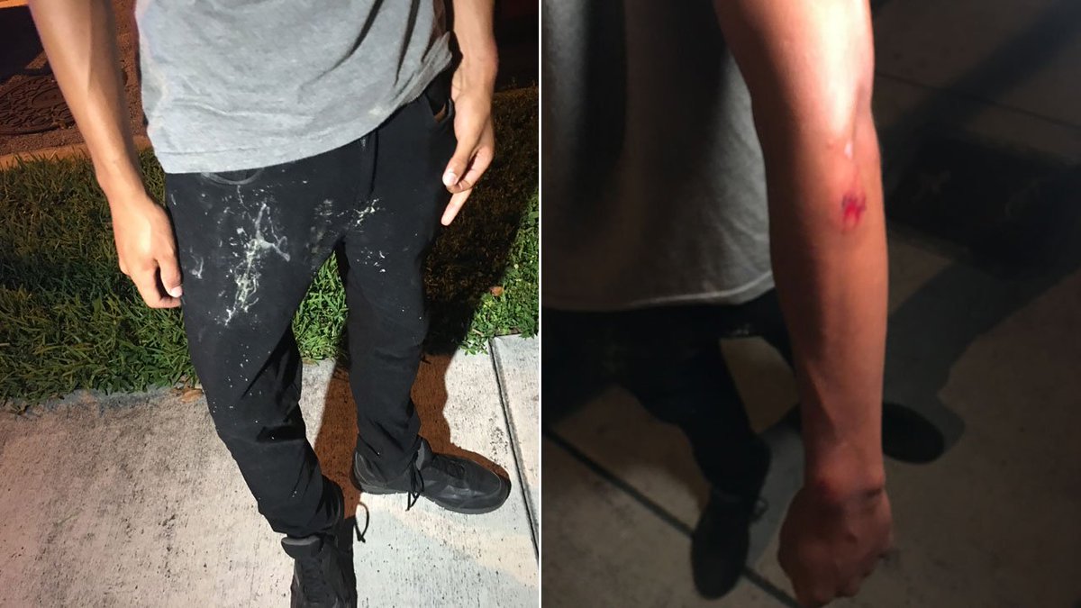 Miami police investigating paintball gun shootings in Wynwood bit.ly/2KqpEgs https://t.co/56zNGvP1mX