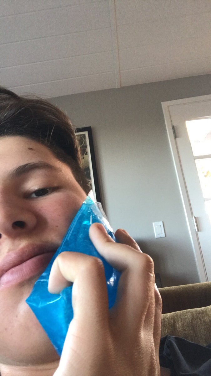 Wes55Burton's tweet photo. Bummed I couldn’t be there for my guy @kikehndez bobblehead night, but I’ve got a doctors note to excuse my absence! Although it kinda hurts! #RIPWisdomTeeth #NoDairyYesGluten https://t.co/dupe8imB5e