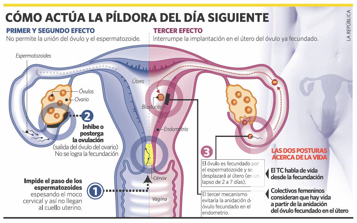 CIFEM_mx's tweet photo. #InfoSalud #Sexualidad Así funciona la píldora del día siguiente. https://t.co/0pvO2cAKQH