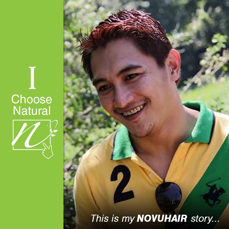 NovuhairNatural's tweet photo. NOVUHAIR is not what people like me grew up with but this is very effective https://t.co/2JfBK6h4Xv 
 #choosenatural #ichoosenatural #novuhair #novuhaircares
#novuhairnaturalwoman #youraisemeup #hairloss #hair #hairlosstreatment #haircare #novuhairworks https://t.co/OnSAlGI5qk