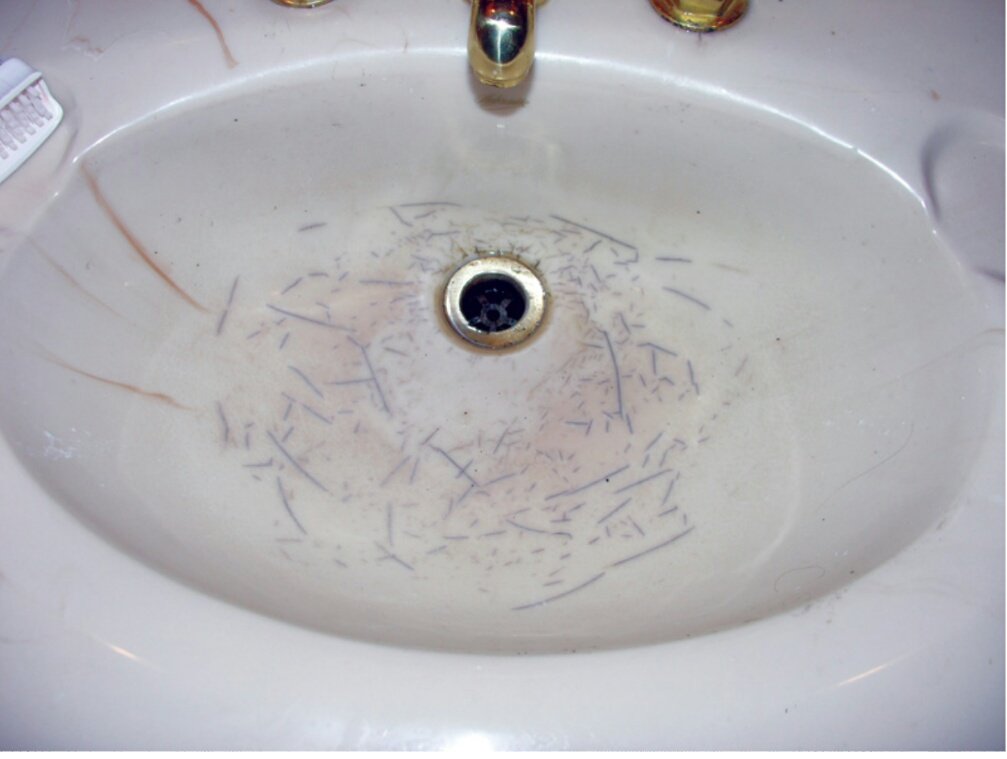 Dmuzi1's tweet photo. This doesn't have to be your sink anymore. Contact us for a happy ever after. #plumbers #plumbing #NGAARG #waterleaks #slableaks #blockeddrains #waterlines #sewers https://t.co/yYcovMIuou