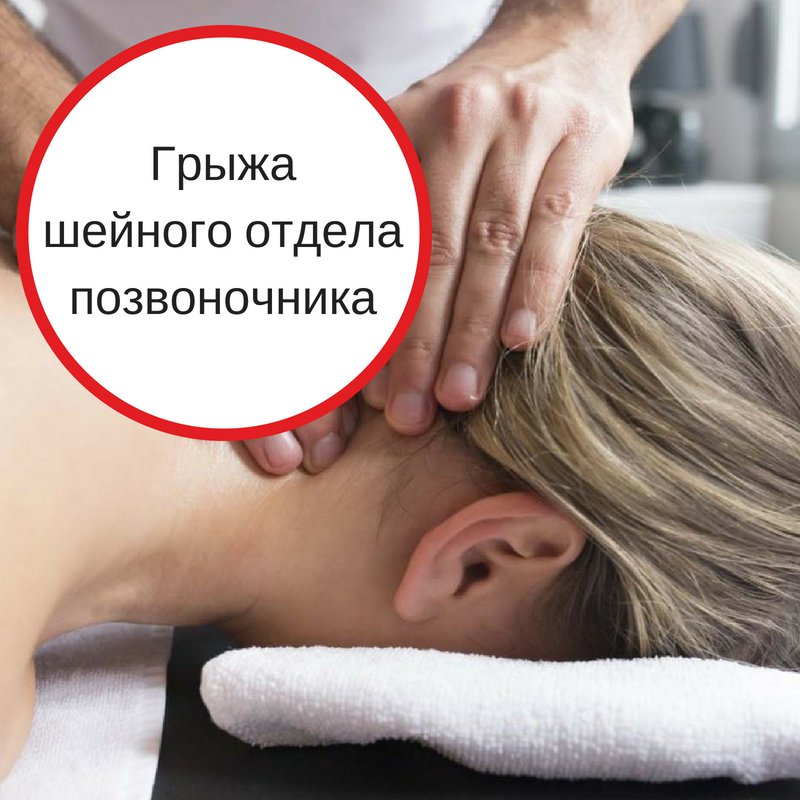 Как вылечить шейную грыжу