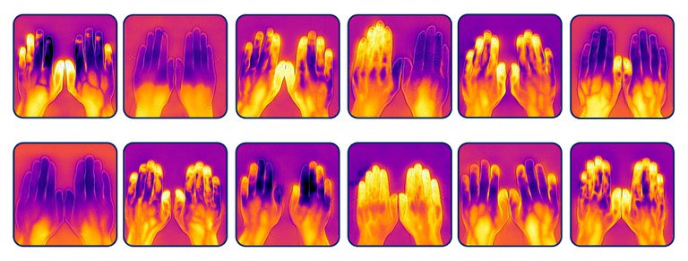 UCamArchaeology's tweet photo. Keeping cool in the #Heatwaveuk? 😎Discover how the body regulates its temperature from @StephPayne627 on #r4today @BBCRadio4 this morning (listen from 02:55:55 https://t.co/toNvlYvNDX) or read her #openaccess research in AJPA 👉https://t.co/BOFZjhbdWj https://t.co/rQI30O2OgQ