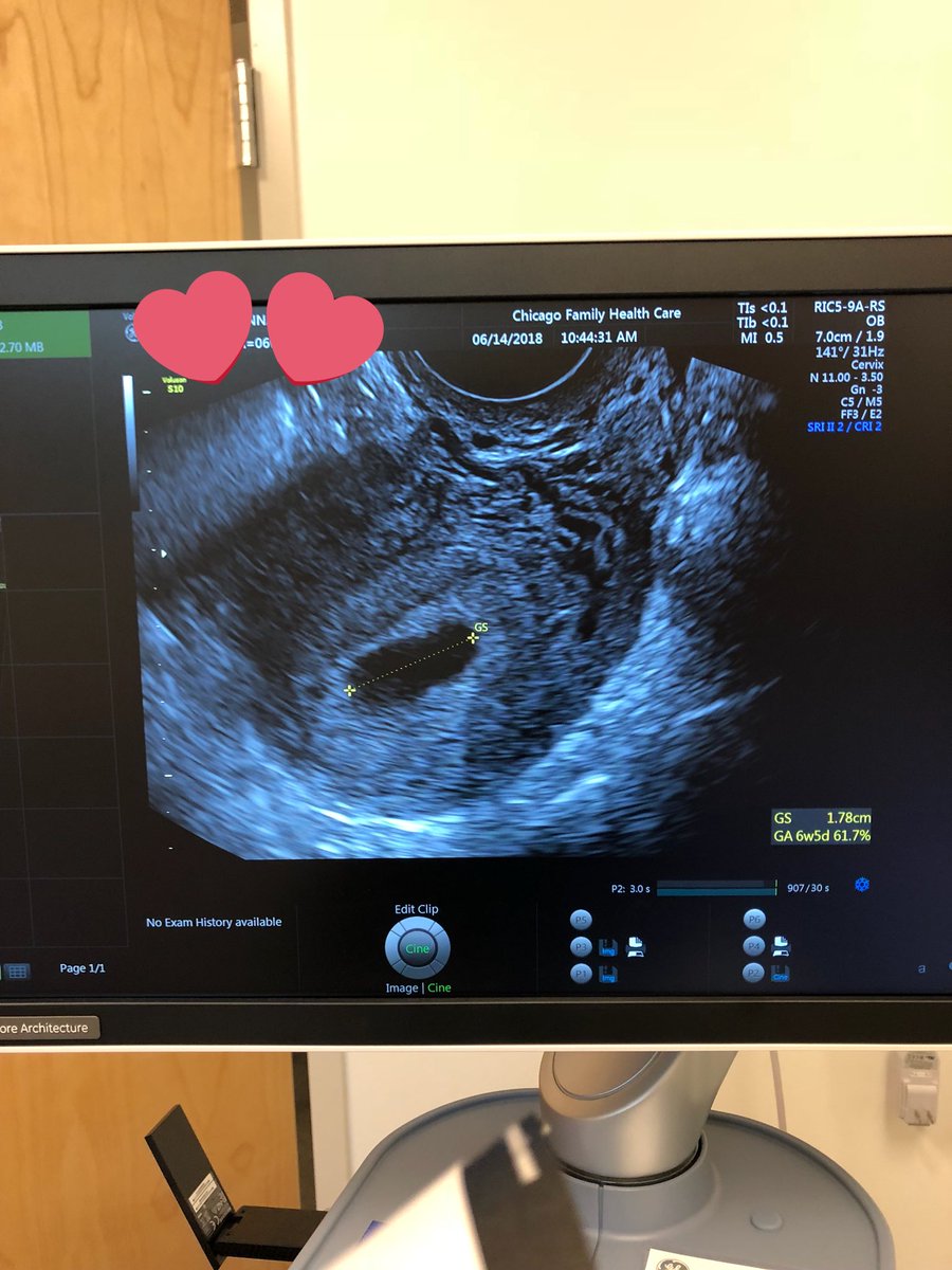 boss_tkillaaa's tweet photo. Can’t wait until I️ find out what we are having ❤️ https://t.co/6XioFhBdx9