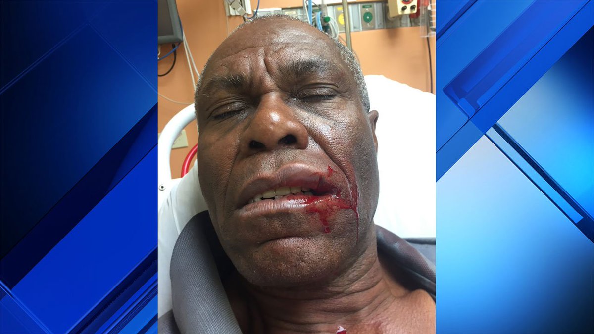 Business owner sucker punched by stranger in Little Haiti bit.ly/2KtBpmk https://t.co/LWYniiKlu0