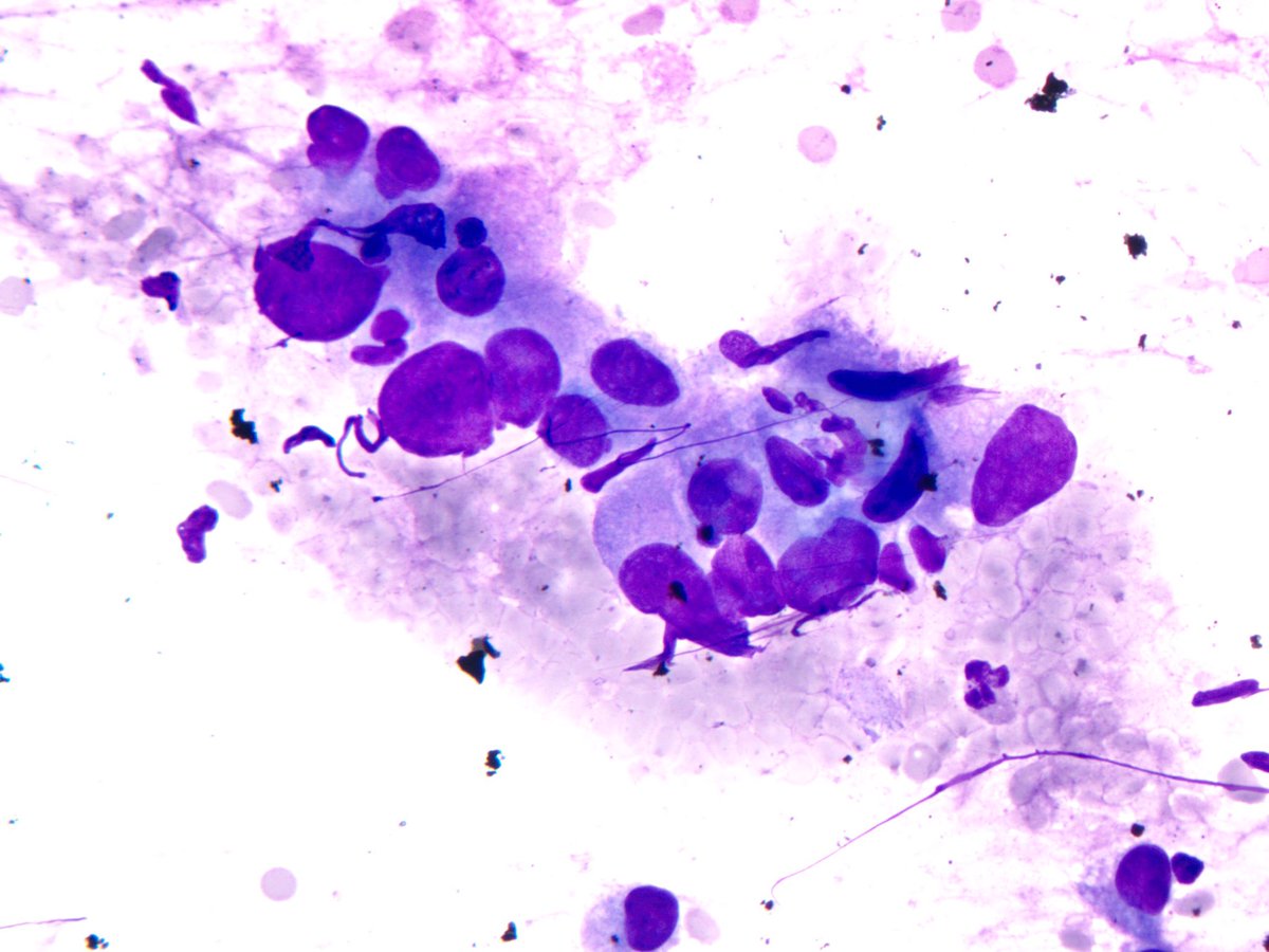 smlungpathguy tweet picture