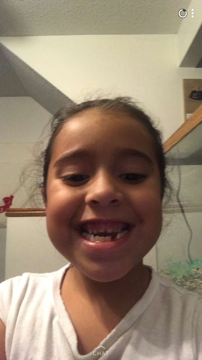 abeatriiz_'s tweet image. A Joanellys se le cayó otro diente 😭😍😇 #mybaby #teveopronto