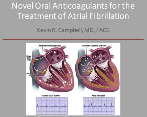 Dr Kevin Campbell presenting on novel oral anticoagulants for optimal atrial fibrillation patient care. To view this talk and many others, please join us at cardiacinnovate.com #learndifferently #shareknowledge #MD2MD #AF <a href="/DrKevinCampbell/">Dr. Kevin Campbell, MD, FACC, MBA</a>