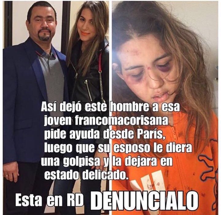 erickmax026's tweet photo. Esta es una joven de san Francisco de macoris, RD que se fue e de viaje junto a su espeso y fue golpeada por el mismo y lanzada ala calle y necesita ayuda. @MilagrosGermanO @Telenoticiasrd @nuriapiera @rcavada @AliciaOrtegah  @SIN24Horas https://t.co/VgXvMmNW3p