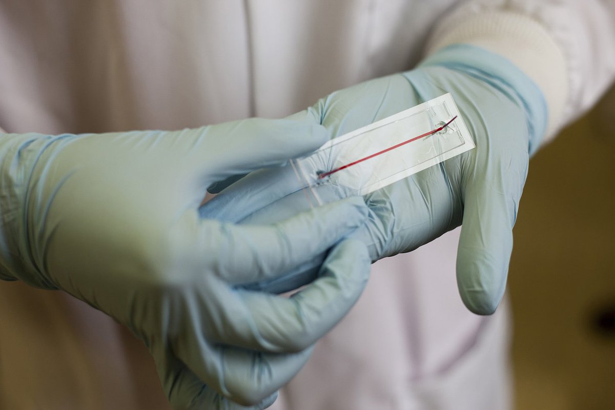 After inventing a sepsis-detecting chip, #TexasTech researchers are seeing success for human patients! Studies show the chip is 98 percent accurate at detection, which could save more lives from this potentially fatal condition! ow.ly/IM8A50hWGVS #DegreesOfImpact