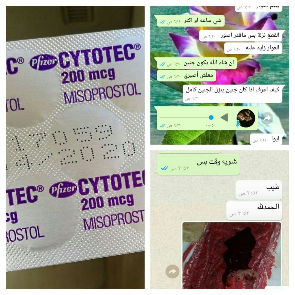 #حبوب سايتويتك  الرياض الدمام  جده الطائف مكه القصيم  الامارات قطر  الكويت  سكاكا التسليم باليد الدفع عند الاستلام للطلب عبر رقم 00962780958326