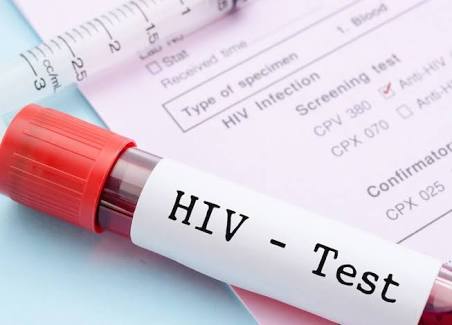 APYINGOMBE's tweet photo. Do you wannna discuss your  Hiv status with someone?#knowyourstatus....@NACANigeria @SFHNigeria @APCNigeria @UN @unicef_aids @learn_positive @Yplus_network https://t.co/0QM66QSWuJ