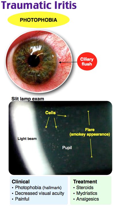 NachiGupta's tweet photo. Ep 43 of @Roshcast: Pulmonary Embolism, Colchicine, Facial Paralysis, Cervical Spine Injuries, Blast Injuries, Traumatic Iritis
https://t.co/eGKISaSx6s
https://t.co/kjhepF6RkV
#foamed https://t.co/v2xaywgIhK