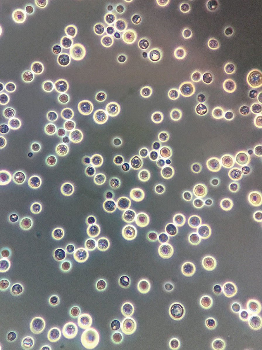 CaroUrbinaCUCS's tweet photo. Tinción de LCR con tinta china que identifica claramente la cápsula de #Cryptococcusneoformans 😍🍄🤕 @NEJM https://t.co/ekKfWWsdFo
@gabcn0414 #lakkesvida #udgagora https://t.co/bJpn5ntdnc