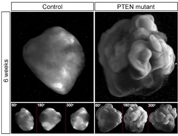 suregenomics's tweet photo. New modeling created by understanding how #genes affect cell development in the brain https://t.co/K77BYGu0vl  great article @scienmag thx https://t.co/vhDuVyz3cW