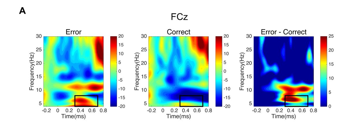 RachelePezz's tweet image. Check our last work on error monitoring!
Error-related EEG signatures depend on salience, and not frequency @JNeurophysiol @SCNL_AgliotiLab @salvatoraglioti
#actionobservation #errormonitoring #oscillations #virtualreality #prediction
physiology.org/doi/10.1152/jn…