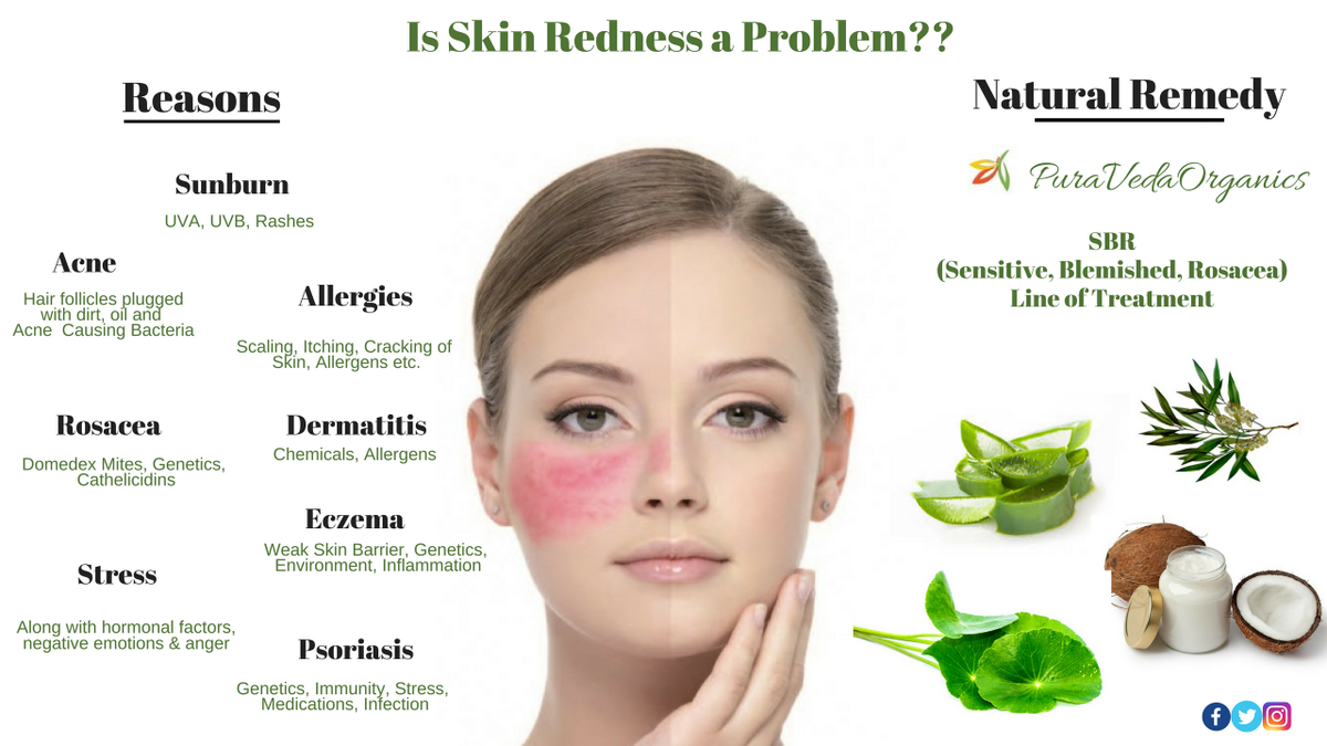 PVOrganics's tweet photo. Follow #PuraVedaOrganics guide to learn what causes #skinredness and how to manage it naturally with our #SBRLine of treatment. https://t.co/hbmc2Td1S3
♥#CouponCode: ‘SKINREDNESS’ to get 15% off
#OrganicMoisturiser #OrganicSkincare #NoHarshChemicals #SensitiveSkin #GreenBeauty https://t.co/b5gD6Z2jYa
