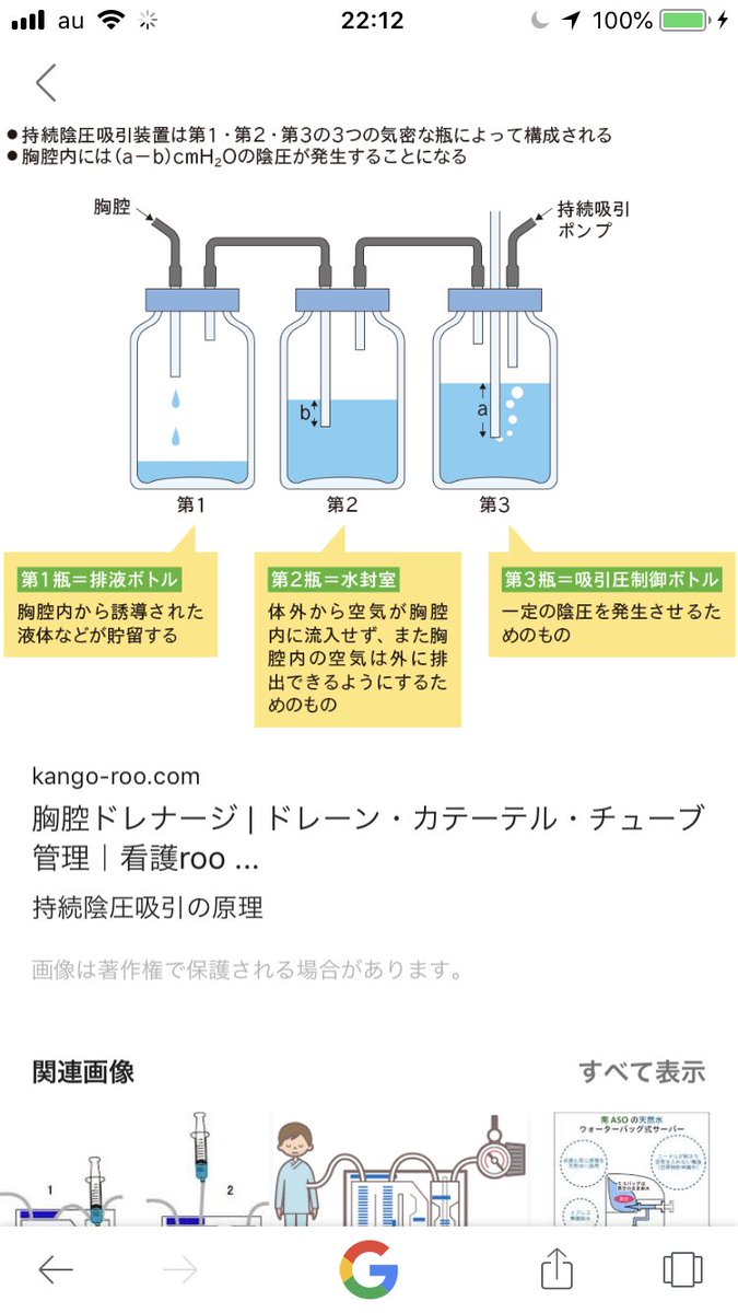 ドレーン 胸腔