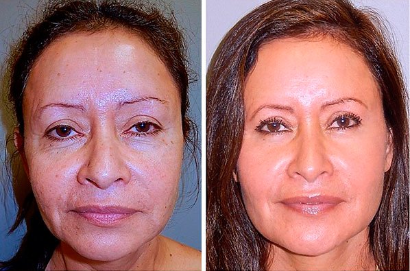 Chào mọi người! Tôi là Mỹ Linh, tôi 40 tuổi mẹ của bảy đứa con. Không đùa! Mọi người thường hỏi tôi: bạn có chắc đó là tuổi thực của bạn? bgtrs.pro/?target=-7EBBQ…