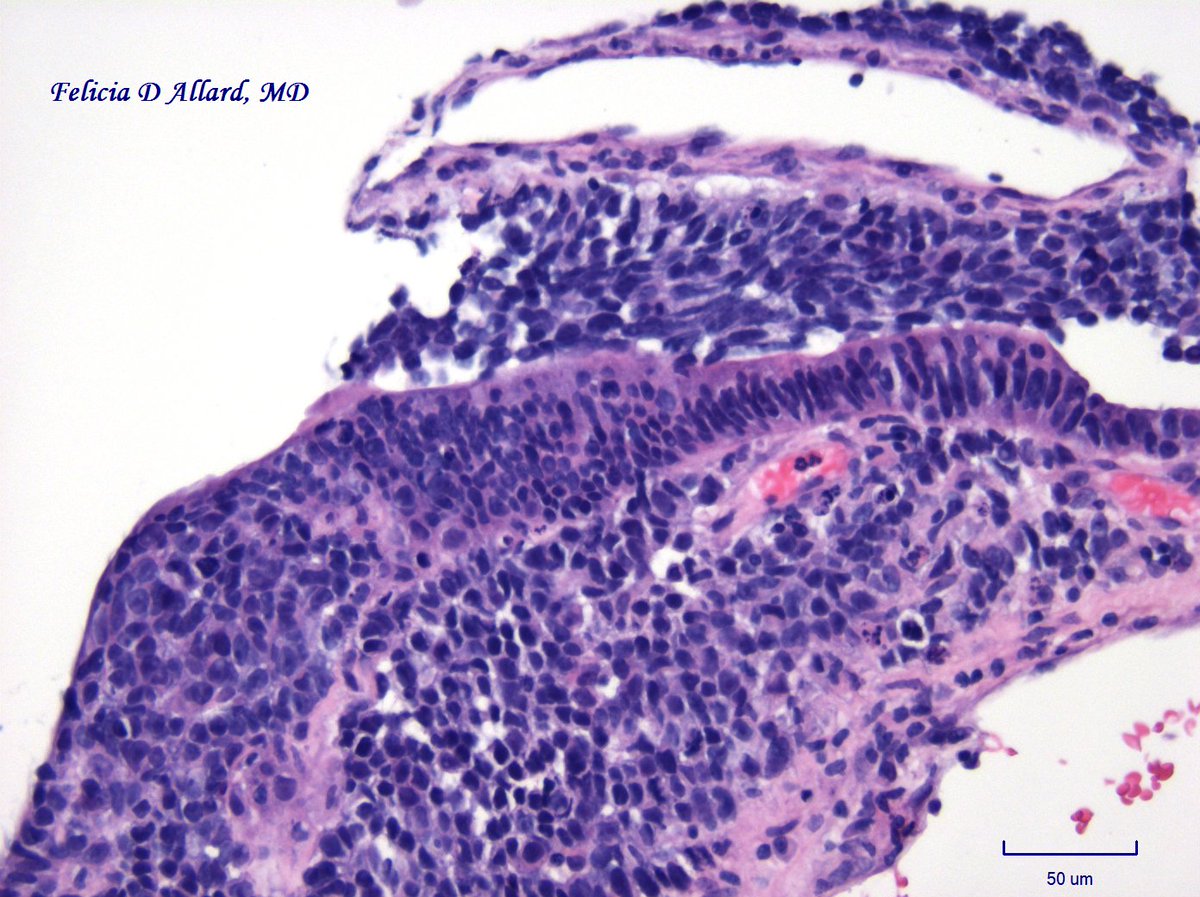 pdf allgemeine pathologie