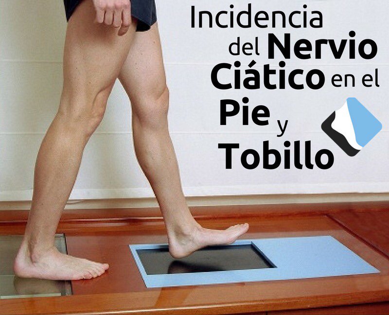Nervio Ciático || La ciatalgia, que se conoce coloquialmente como ciática, es un término que indica dolor (algia) en el nervio ciático (ciat).

Lo recomendable es que sea tratado por un especialista. 
#drpieytobillo #pies #tobillo #traumatologia #venezuela #españa #bilbao