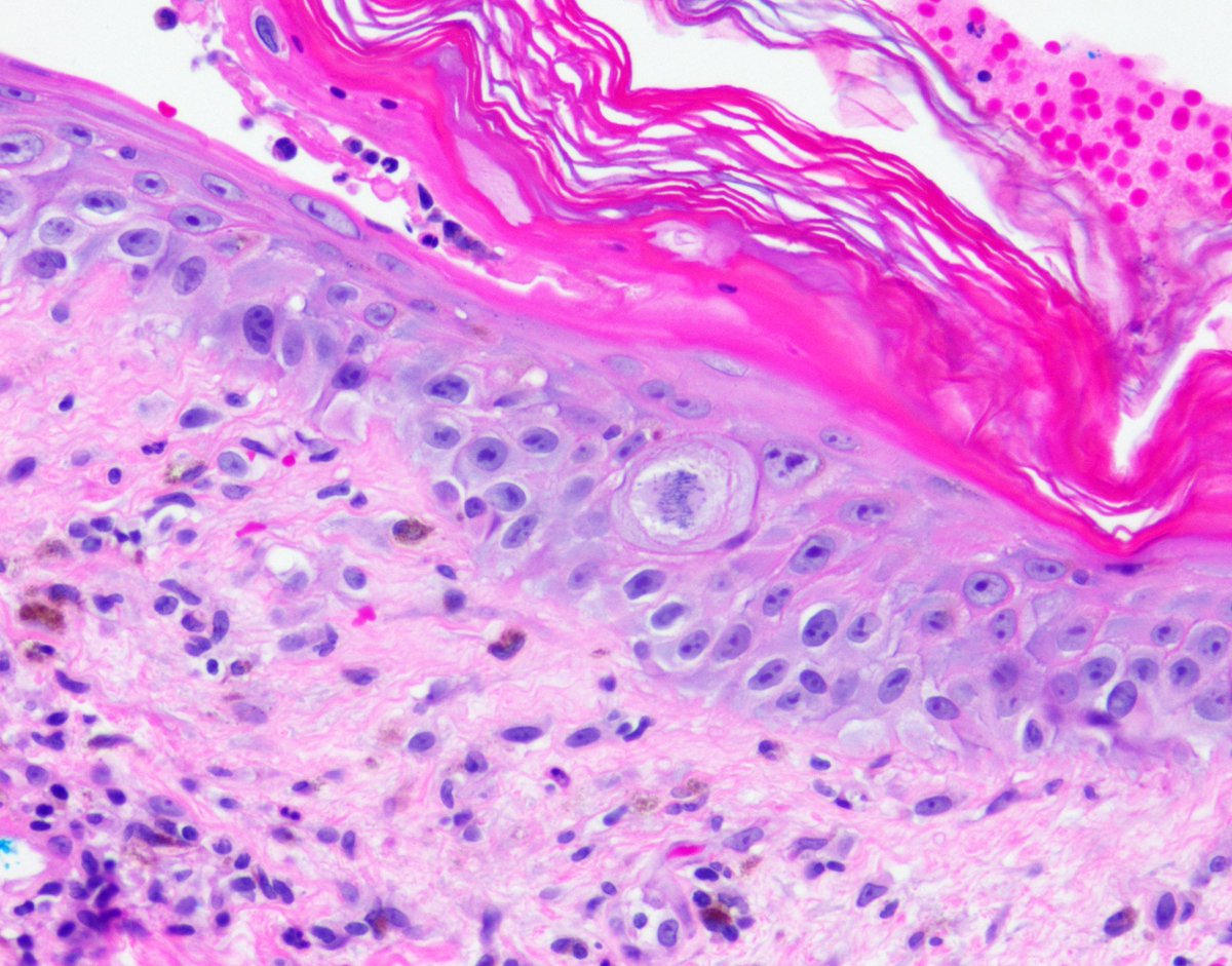 Garth Fraga tweet media