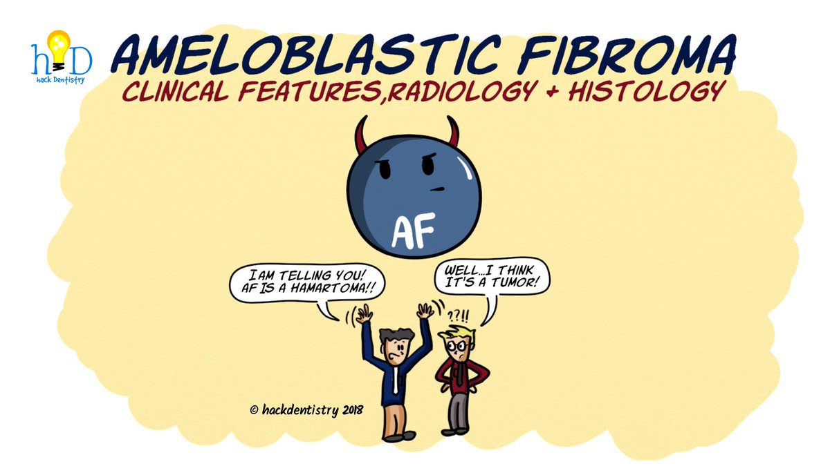 #Ameloblasticfibroma is a rare odontogenic tumor characterized by simultaneous neoplastic proliferation of epithelial and ecto-mesenchymal tissues. Watch the full video: bit.ly/2lIU2Vo
#hackdentistry #oralpathology #odontogenictumors #oralmedicine #nbde #NEET