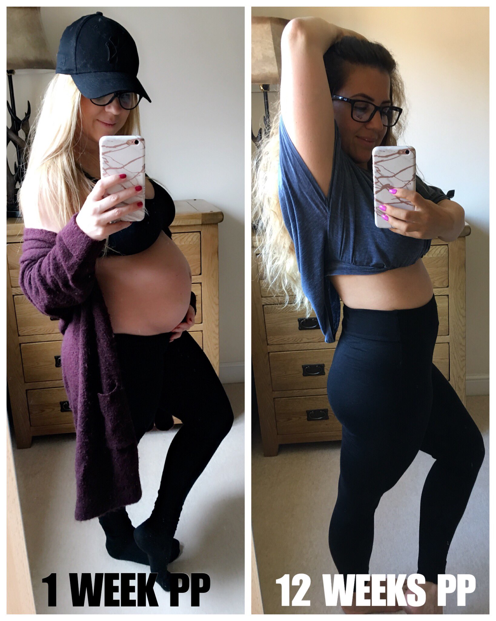 12 Weeks Postpartum Belly Best Pregnancy Support Belt 2024: Maximum