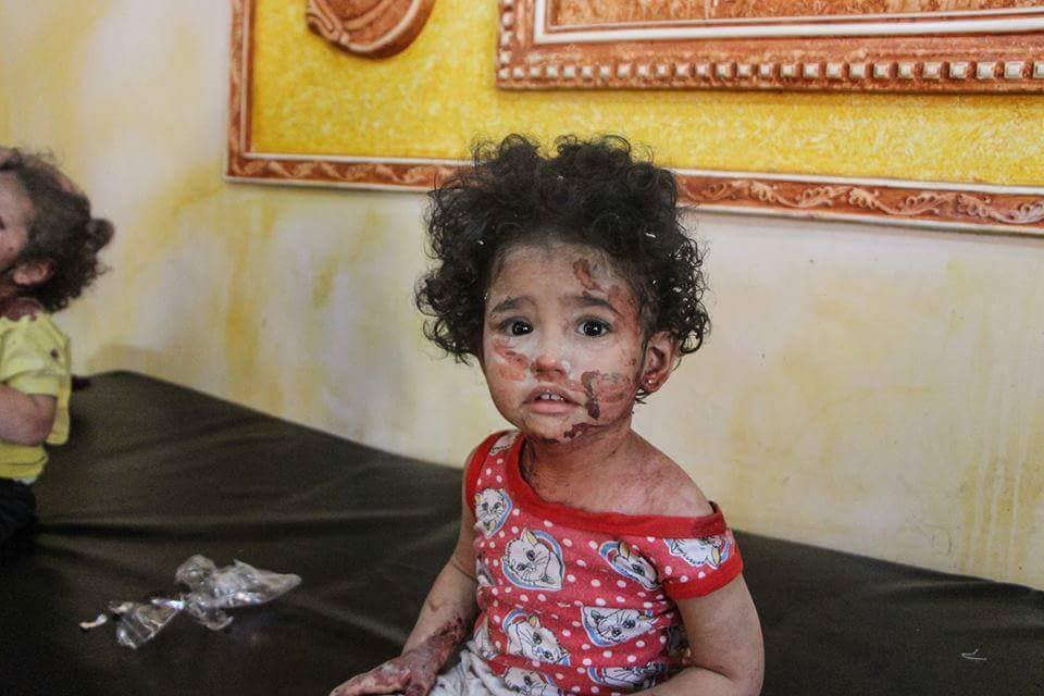 SyriaCharity's tweet photo. Pdt que les yeux du monde entier sont rivés sur la Coupe du Monde en Russie, le massacre des enfants syriens continue à Deraa ds un silence assourdissant. 
+ de 100 morts en qlq jr ss le feu de l'aviation.

Photo: Un enfant blessé par une frappe sur Taybaa à Deraa cette semaine. https://t.co/P2pFcQyLmg