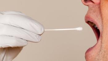 Tükürükten prostat kanseri tespitinde denemelere başlandı haberse.net/saglik/tukuruk…