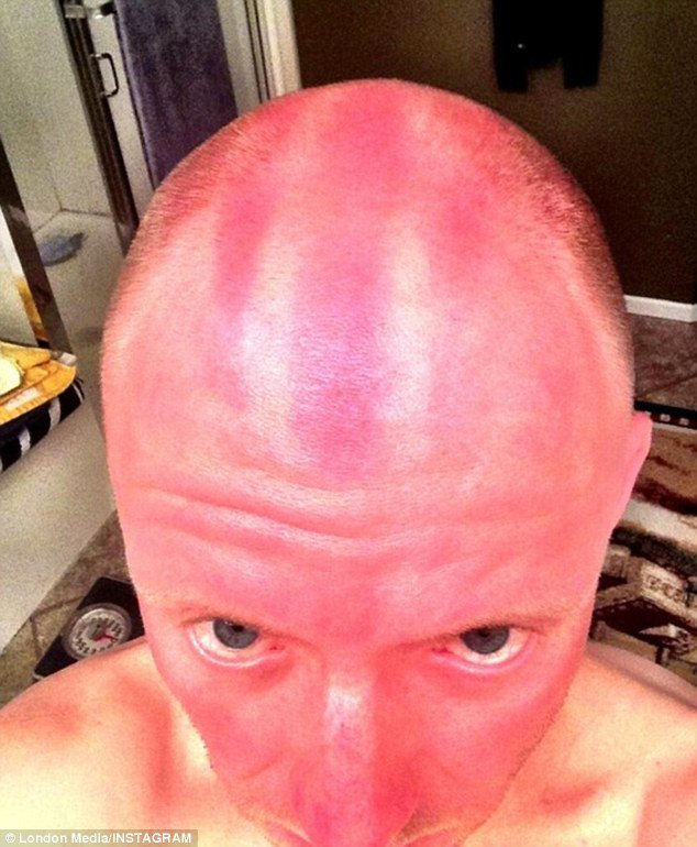 Andy_the_Arab's tweet photo. @BaliUtd Still a bit surprised by this move cause they've no invented a sunscreen strong enough to get Willo through 90 mins in Bali. Half-time and you can guarantee he'll be looking like this. #factor5000 https://t.co/0gk7RpK7lU