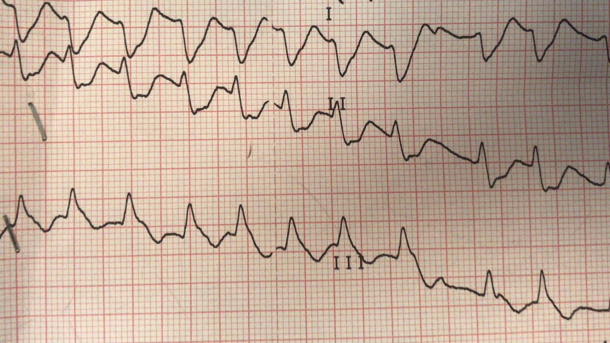 atypicalflutter's tweet image. VT or not VT?  That is the question