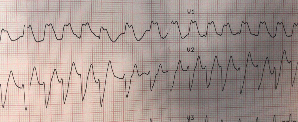 atypicalflutter's tweet image. VT or not VT?  That is the question