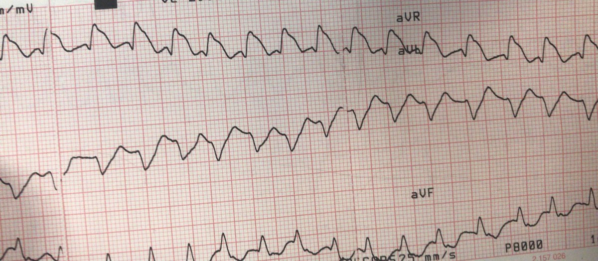 atypicalflutter's tweet image. VT or not VT?  That is the question