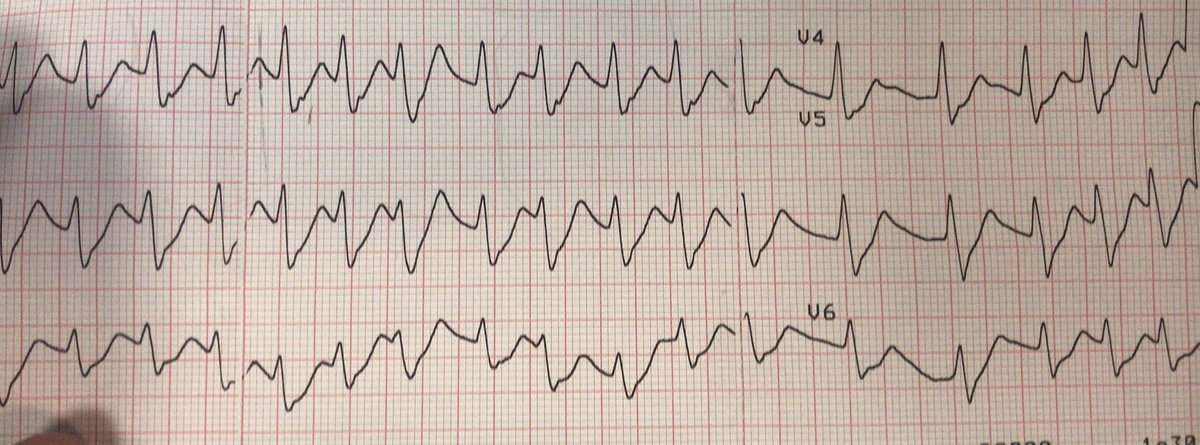 atypicalflutter's tweet image. VT or not VT?  That is the question