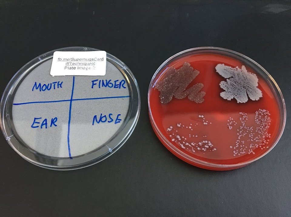 CUSystemsImmu's tweet image. Meet the bugs that are normally invisible but live in your mouth, ear and nose and on your hands or in your armpit - in most cases without causing any harm!

Find here the photos of your bugs from the #CUsuperbugs event on 28 June 2018:
facebook.com/pg/SuperbugsCa…

#wfoi @Techniquest