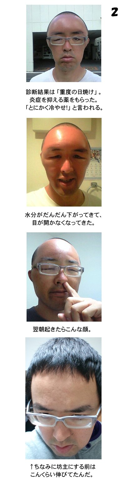 かとうとおる 新しく友だちになってくれた人たちは あの夏の珍事件を知らないだろうから 貼っておきます 11年夏の終わり 突如ボクの身に起きた 写真加工一切なしのドキュメンタリーっス